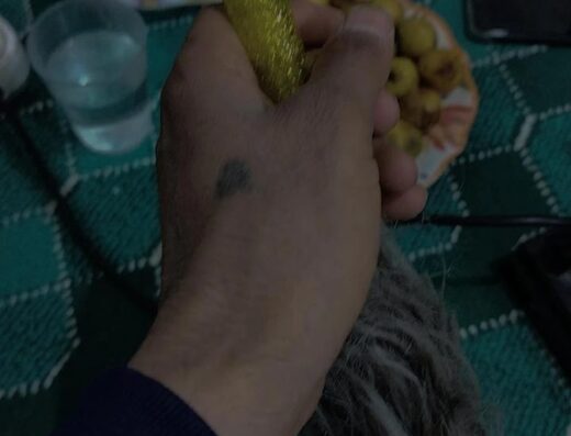 ليزر بيوتي كلينيك