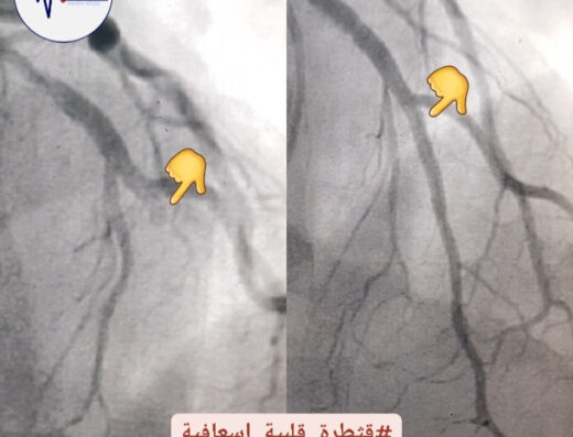 العيادة القلبية في دمشق، الدكتور أيمن عبد الرحمن