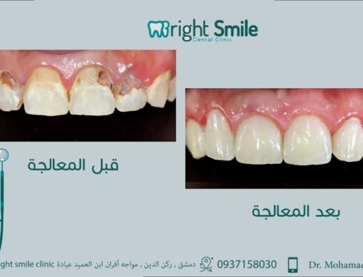 عيادة Bright Smile الإبتسامة المشرقة لطب الأسنان
