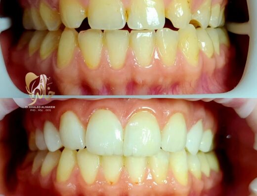 عيادة الدكتور خالد الحكيم لطب وتجميل الأسنان