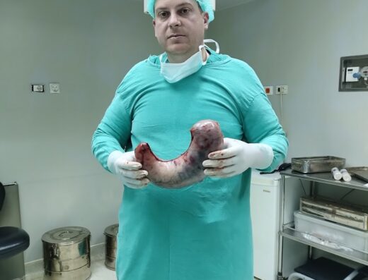 عيادة الدكتور فارس الطير جراحة عامة وتنظيرية