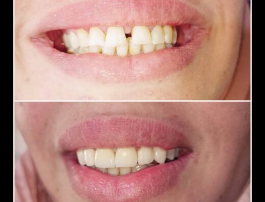 عيادة الدكتور محمد المحاميد لطب الأسنان_beauty smile clinic