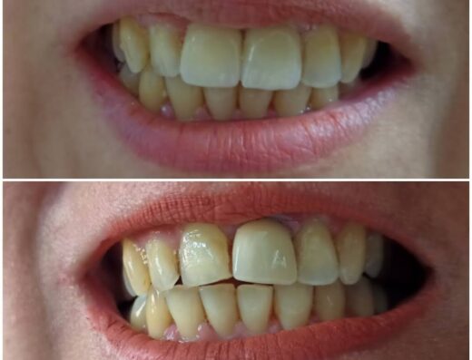 عيادة الدكتور محمد المحاميد لطب الأسنان_beauty smile clinic