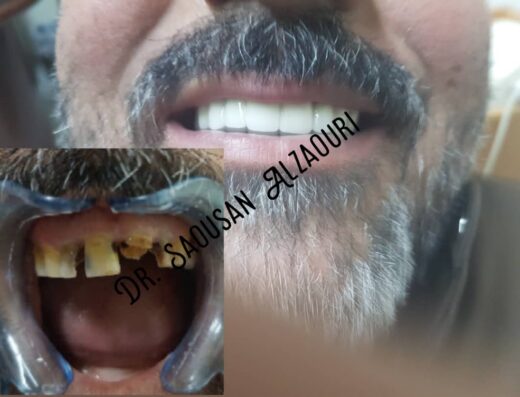 عيادة الدكتورة سوسن الزعوري لتجميل الاسنان