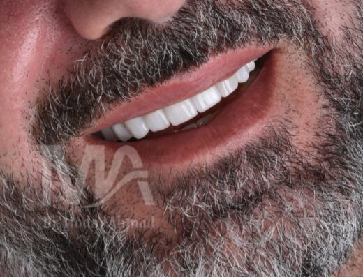 عيادة اللاذقية لطب الأسنان تجميل وزراعة أسنان