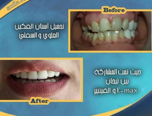Smile AK clinic الدكتور احمد الكمشة