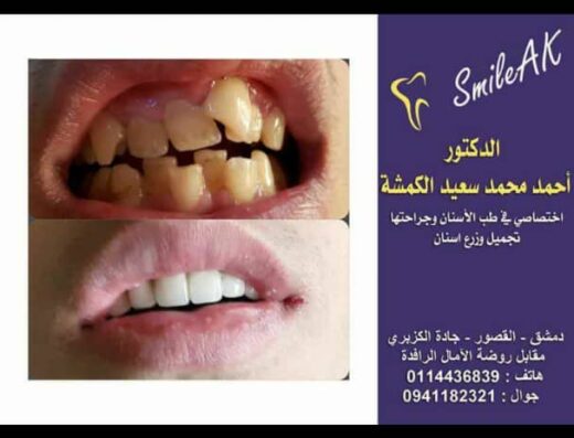 Smile AK clinic الدكتور احمد الكمشة