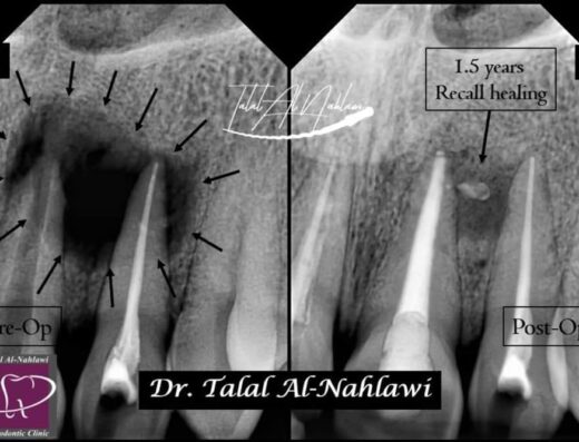 الدكتور طلال نحلاوي