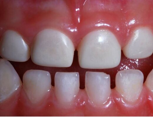 Smart Kinder Pediatric Dentistry Clinic. عيادة د.رهف دك الباب التخصصية لطب اسنان الاطفال
